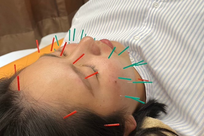 シャンス鍼灸整体院 西原町/骨格矯正/美容鍼灸 | 浦添のリラクゼーション