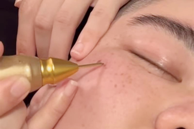 アークサロン柳町店 | 岡山のエステサロン