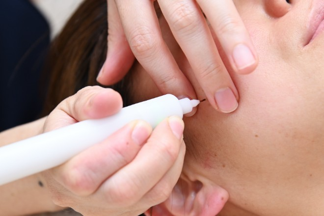 シミ改善専門サロン FLORA(フローラ) | 日置のエステサロン