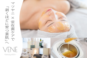 VENE -beauty salon-【ウェヌ】/マツヤニ肌質改善サロン | 富山のエステサロン