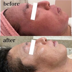 メンズ育毛/脱毛/フェイシャルサロンjoieange心斎橋店 | 心斎橋のエステサロン