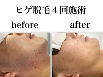 メンズ脱毛フェイシャル専門店 joieange京橋 | 京橋のエステサロン