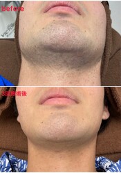 脱毛サロン CHAT | 浜松のエステサロン 脱毛サロン CHAT | 浜松のエステサロン