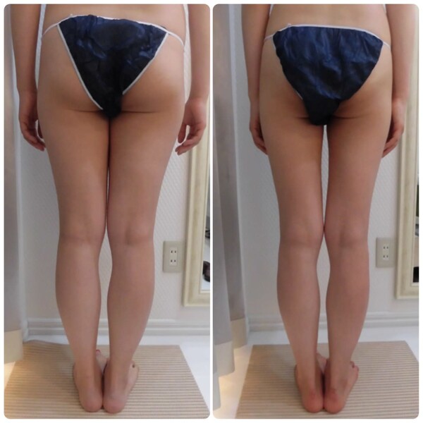 筋膜リリースエステIDM横浜店 | 横浜のエステサロン