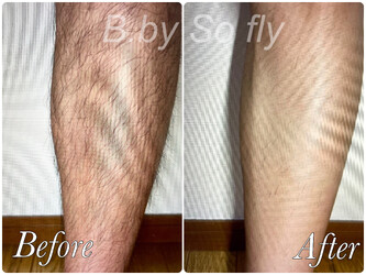 藤沢B.by So fly【痩身エステ・美肌脱毛専門店】 | 藤沢のエステサロン