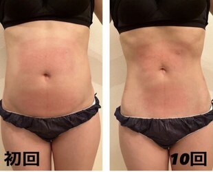 秒速スリム 大宮店 | 大宮のエステサロン 秒速スリム 大宮店 | 大宮のエステサロン