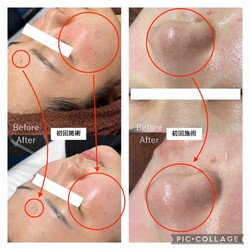 【肌質改善専門サロン/ハーブピーリング/ハイドラ】The Beauty麻布十番本店 | 麻布のエステサロン