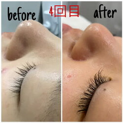 毛穴洗浄・脱毛サロンarchange /アルカンジュ | 本町のエステサロン 毛穴洗浄・脱毛サロンarchange /アルカンジュ | 本町のエステサロン