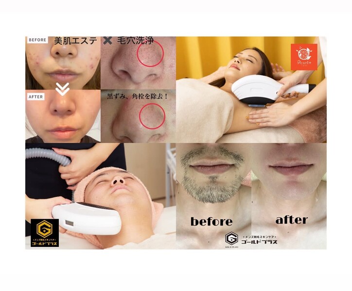 美肌脱毛専門店 Pearl plus 東岡山店【パールプラス】【小顔/痩身／フェイシャル】 | 岡山のエステサロン