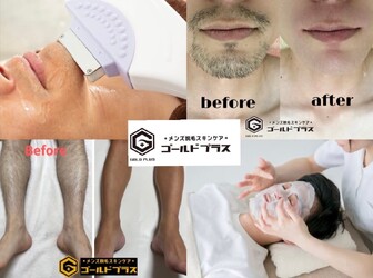 美肌脱毛専門店 Pearl plus 東岡山店【パールプラス】【小顔/痩身／フェイシャル】 | 岡山のエステサロン