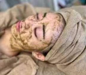 ビューティーLaBo T'style 赤坂 | 赤坂のエステサロン