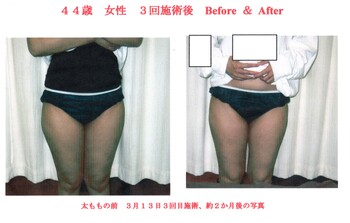 前田カイロプラクティック整体院ダイエット | 高知のエステサロン