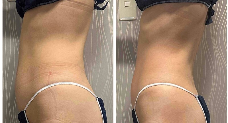 body salon Futh | 本町のエステサロン