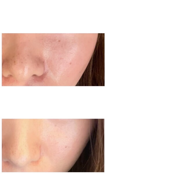 Salon de beaute belle lune | 日本橋のエステサロン