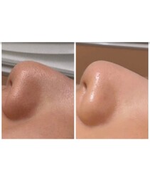 Ultimate | 心斎橋のエステサロン