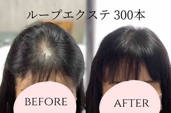 total beauty IRIS | 横川/十日市/舟入/西広島のヘアサロン