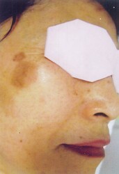 リラクエステ希望 | 仙台のエステサロン