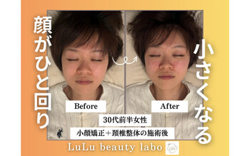小顔矯正/美容整体 LuLu beauty labo【ルルラボ】 | 博多のエステサロン 小顔矯正/美容整体 LuLu beauty labo【ルルラボ】 | 博多のエステサロン