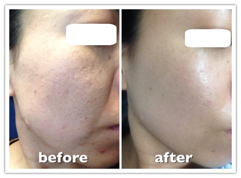 Health Beauty Produce J.O | 鶴橋のエステサロン