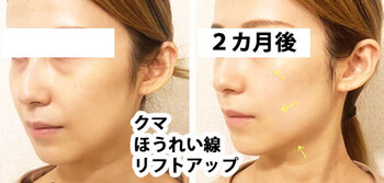 et Luxe | 三宮のエステサロン