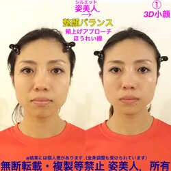 3D小顔矯正+筋膜リリース+肩甲骨はがし+姿勢 「姿美人.」(シルエット) | 九条/弁天町のエステサロン 3D小顔矯正+筋膜リリース+肩甲骨はがし+姿勢 「姿美人.」(シルエット) | 九条/弁天町のエステサロン