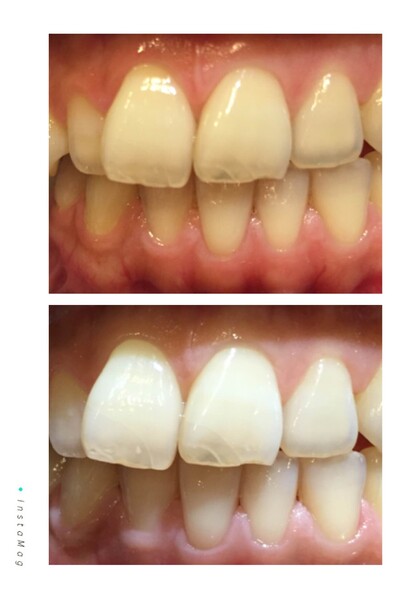 Psyche | 四条烏丸/五条/西院のエステサロン