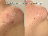 Rairy【ライリー】【美白/ヘッドスパ&イヤーエステ/フェイシャル】 | 袋町/本通/紙屋町/立町のエステサロン