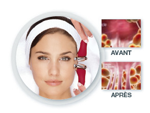 LACOPINE 大阪店 | 梅田のリラクゼーション LACOPINE 大阪店 | 梅田のリラクゼーション