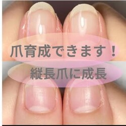 深爪 自爪育成 脱毛サロン elle& | 灘/住吉のネイルサロン