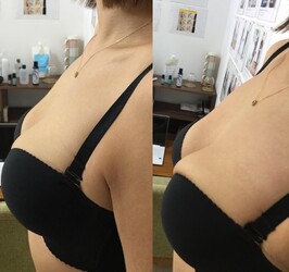 中津市でダイエットやバストアップ．脱毛などの見た目を変える整体 | 中津のエステサロン