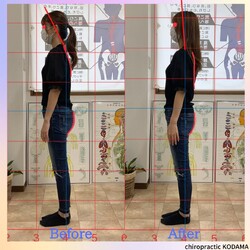 カイロプラクティックKODAMA | 大曽根/黒川のリラクゼーション