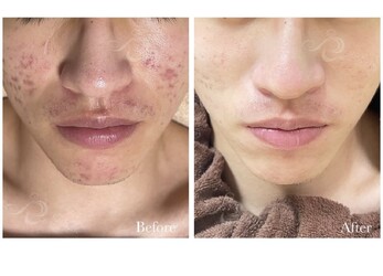 S salon | 札幌駅周辺のエステサロン