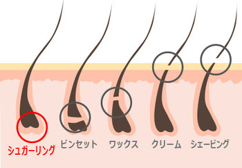 シュガーリング＆ブラジリアンワックス 脱毛 Lamina新宿 | 新宿のエステサロン