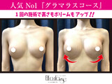 【バスト＆ヒップ専門店】エルフラージュ銀座店 | 銀座のエステサロン