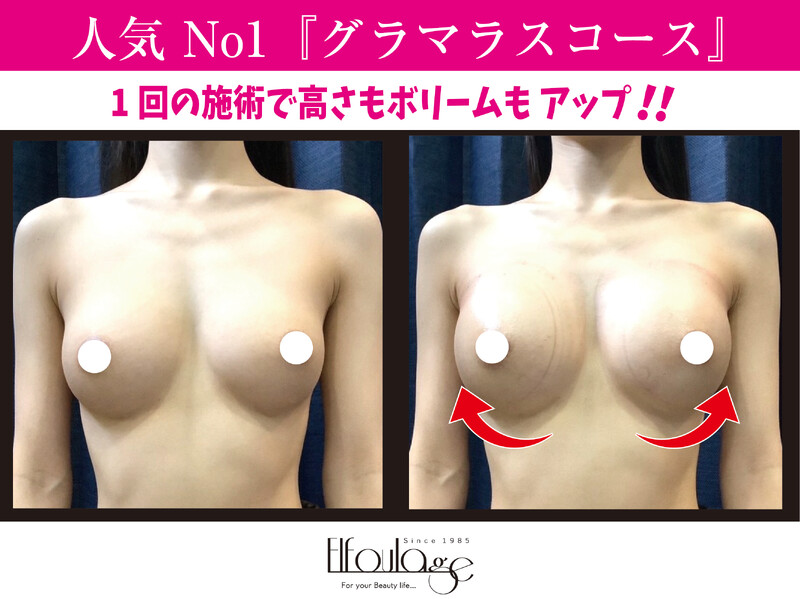 【バスト＆ヒップ専門店】エルフラージュ銀座店 | 銀座のエステサロン