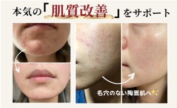 Re Ange豊見城店 | 那覇のエステサロン