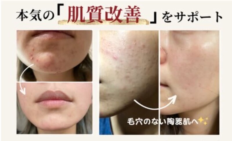 Re Ange豊見城店 | 那覇のエステサロン