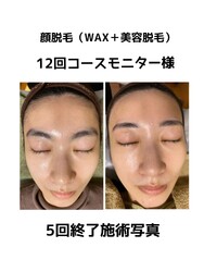 Organic SHAKA | 西陣/北野天満宮のエステサロン