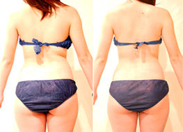 メディカルエステ ヴォワールドボーテ | 千歳烏山のエステサロン