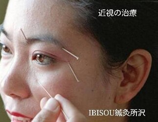IBISOU 鍼灸所沢 | 所沢のリラクゼーション