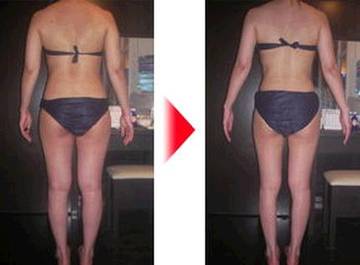 BCCパーフェクト | 銀座のエステサロン BCCパーフェクト | 銀座のエステサロン