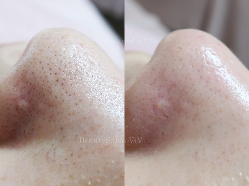 BeautySalon ViVi | 千葉のエステサロン