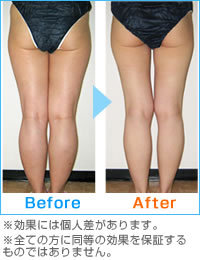 エステティック フォーレディ恵比寿/代官山店 | 恵比寿のエステサロン エステティック フォーレディ恵比寿/代官山店 | 恵比寿のエステサロン