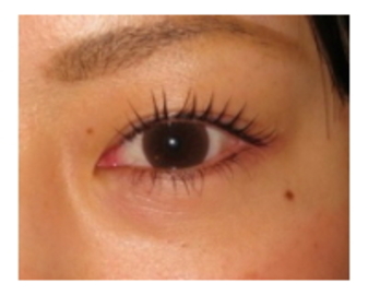 ラ・フォンテ | 阿佐ヶ谷のエステサロン