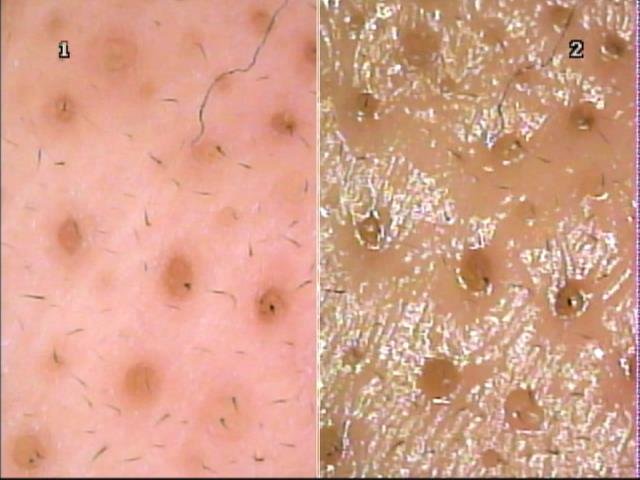 シナモンサロン | 荻窪のエステサロン