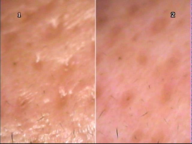 シナモンサロン | 荻窪のエステサロン