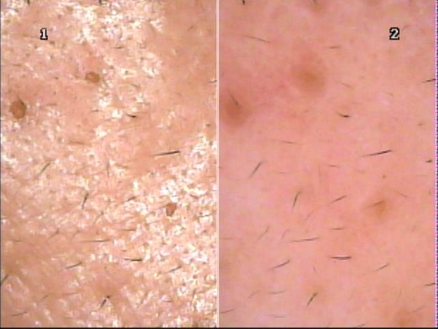 シナモンサロン | 荻窪のエステサロン