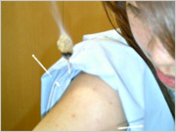 陳鍼灸整骨院 | 銀座のリラクゼーション