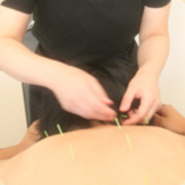 美容鍼　コウ鍼灸治療院 | 新宿のリラクゼーション