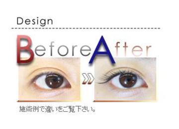 SASSY | 札幌駅周辺のアイラッシュ